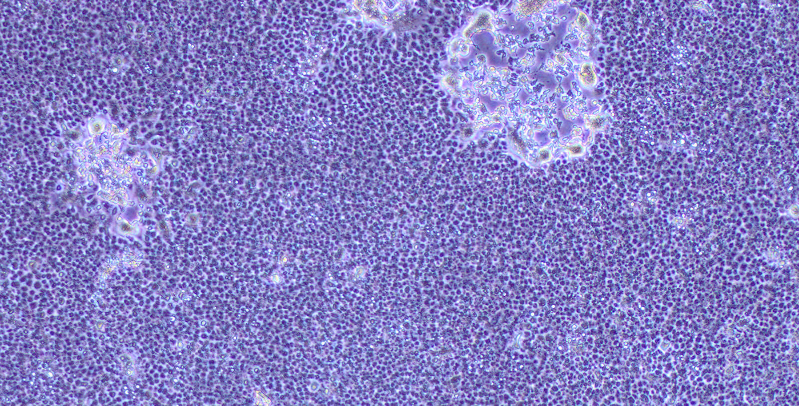 photo of cells infected by coronavirus and virus-denatured